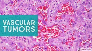 Vascular Tumors of the Skin - Explained by a Soft Tissue Pathologist