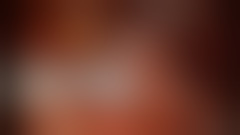 Robotic Assisted Radical Cystectomy in the female by Prof. Dr. Mottrie