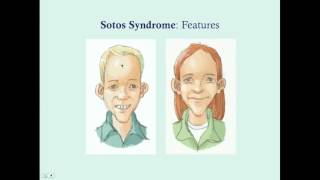 Sotos' Syndrome  CRASH! Medical Review Series