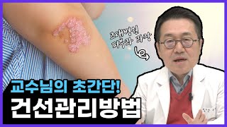 건선으로 고통받는다면? 필수 시청! 건선 관리 방법, 초간단 정리 들어갑니다!  - 고대병원 피부과 교수