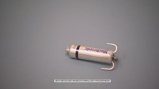 Pennsylvania Baby Receives Smallest Pacemaker In The World