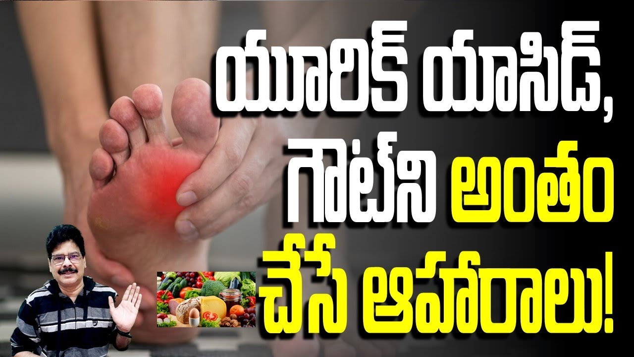 యూరిక్ యాసిడ్, గౌట్‌ని అంతం చేసే ఆహారాలు..! By Dr. Murali Manohar Chirumamilla, M.D. (Ayurveda)