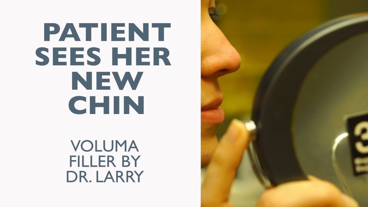 Real Patient Reaction After a Nonsurgical Chin Augmentation with Juvederm Voluma