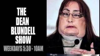 CHARLA NASH THE CHIMPANZEE ATTACK VICTIM 102.1 The Edge DEAN BLUNDELL SHOW