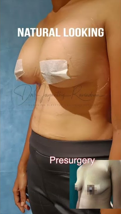 Breast Implant | Tamira Plastic Surgery