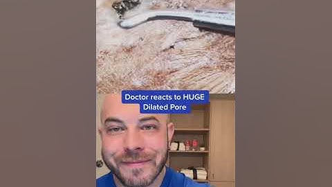 Doctor reacts to massive, dilated pore! #blackhead #pimplepop #dermreacts #doctorreacts