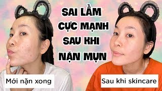 Top 10 Cách Làm Dịu Da Mặt Sau Khi Nặn Mụn Đặc Sắc Nhất Năm 2022