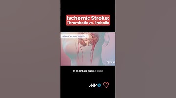 Types of Ischemic Stroke 🧠