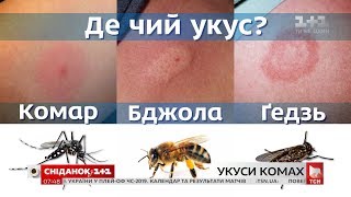 Как распознать опасный укус насекомого и правильно на него среагировать - советы дерматолога