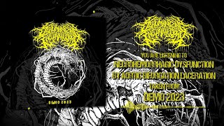 DEHUMANIZING ENCEPHALECTOMY - DEMO 2023 [OFFICIAL STREAM] SW EXCLUSIVE