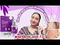 The Derma Co Niacinamide Serum Review | The Derma Co 10% Niacinamide Face SerumReview|2025