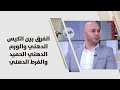 د. سعيد الدبس - الفرق بين الكيس الدهني والورم الدهني الحميد والفرط الدهني - طب وصحة