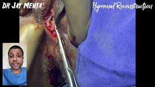 Hymenal Reconstruction Re Virginity Surgery Hymenoplasty Cosmetic Gynecology Dr Jay Mehta