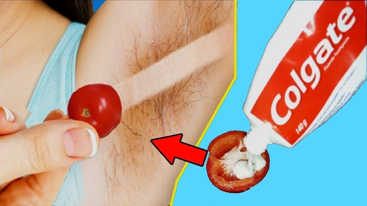 How I Removed My Armpit Hair Permanently At Home Remove Underarm Hair Naturally Youtube