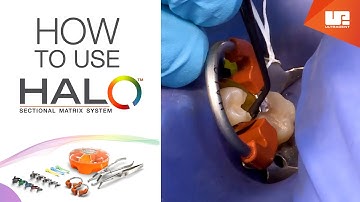 How to Use Halo™ sectional matrix system