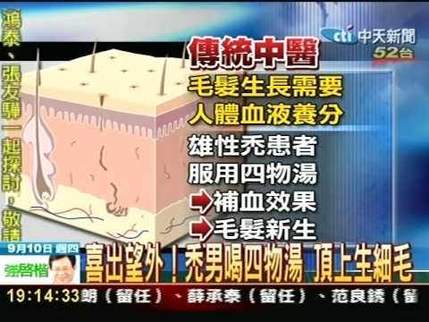 喜出望外 禿男喝四物湯頂上生細毛 Youtube 喜出望外 禿男喝四物湯頂上生細毛 Youtube