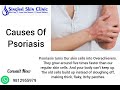What is psoriasis    symptoms causes  treatments  dr himanshu singhal