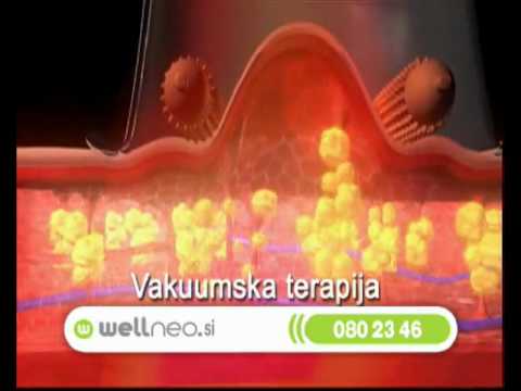 Celluless MD Sistema Anticelulítico Vacumterapia 