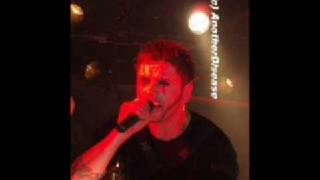 Watch Oomph Who You Are video