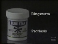 Blue star ointment  television commercial  1991