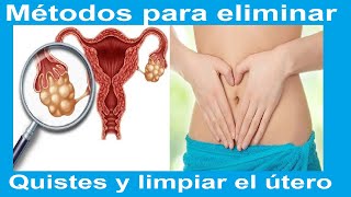 Mira 👀 🙀Como Eliminar los Quistes de Ovarios Y Limpiar el Útero con Estos Remedios Caseros🙀🙀