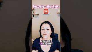 Bee Sting? Dont Panic But Watch For This