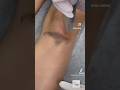#hollywoodpeel #carbonpeeling #carbonpeel #darkknees #dark knee #collagenstimulation