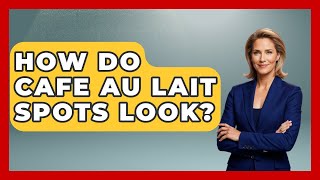 How Do Cafe Au Lait Spots Look? - Skin Savvy Dermatology