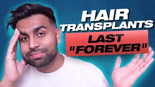 STUPID HAIR TRANSPLANT MYTHS YOU MUST KNOW BEFORE GETTING ONE