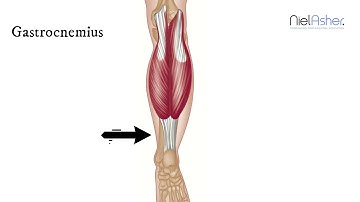 How To Find Trigger Points - Gastrocnemius