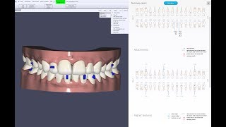 Simplyceph software screenshot 2