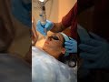 Carbon Facial Treatment in jaipur, Best Dermatologist in Jaipur, Hollywood peel treatment in jaipur