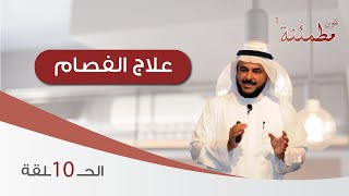 البروفسور طارق الحبيب | علاج الفصام