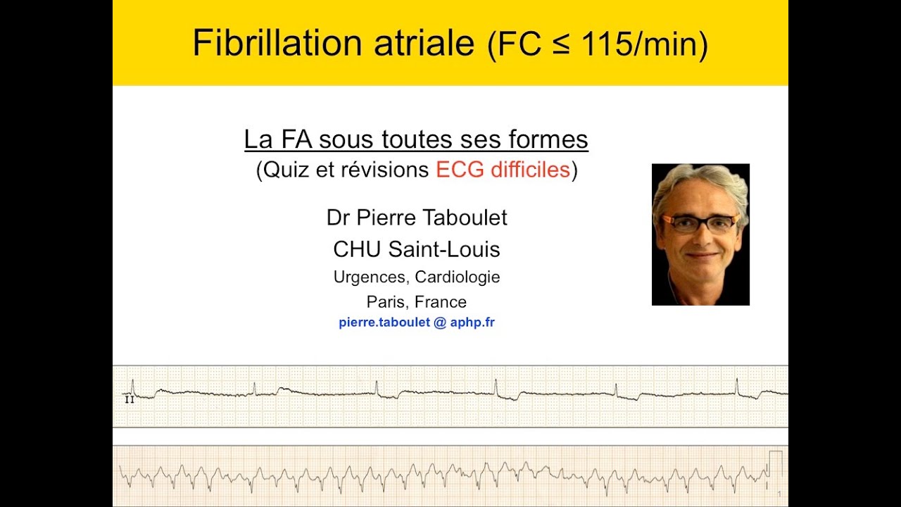 5a. La fibrillation atriale sous toutes ses formes. FC inférieure à 115/min. Dr P. Taboulet