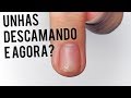 UNHAS DESCAMANDO: O que fazer? Por que elas descamam?