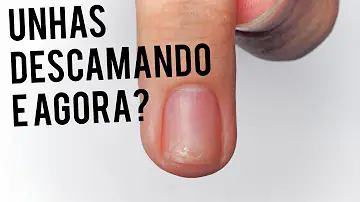 Porque as unhas descamam por cima?