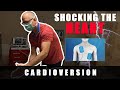 Atrial Fibrillation - Shocking The Heart Into Normal Rhythm With DC Cardioversion