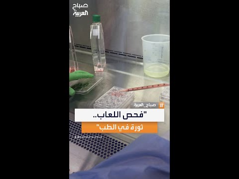 اختصاصي جراحة المسالك البولية ناصر رمضان فحص اللعاب للرجال يمثل ثورة طبية حديثة في التشخيص المبكر