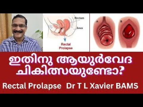 Porno keksa ayollar hukmronlik qiladi Voyeur porno toplamlari