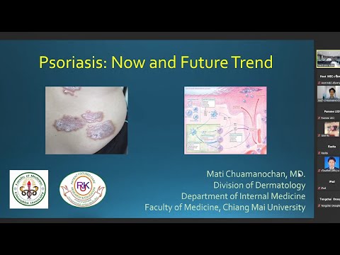 Psoriasis: Now and Future Trend