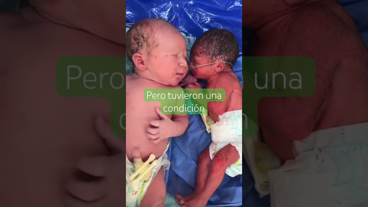 Bebés gemelos con Restricción del Crecimiento intrauterino. ¿Conocías esa condición?