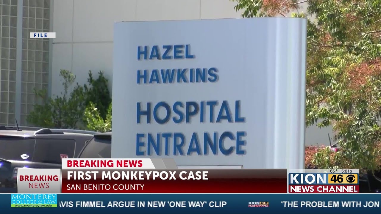 First case of Monkeypox confirmed in San Benito County - YouTube