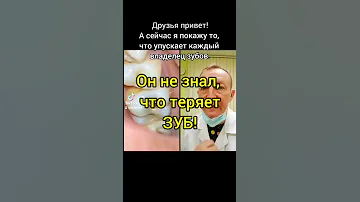 Он не знал, что теряет зуб! #shorts #doctor #зубы