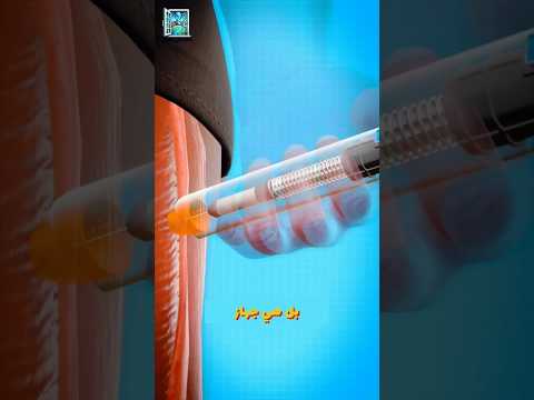 تجنب الحوادث المؤلمة