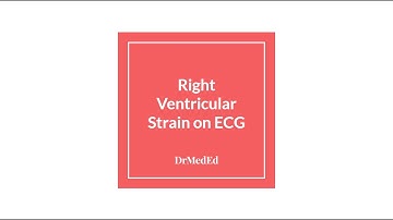 Right Ventricular Strain on ECG