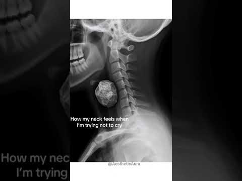 🫠 #relatable#crying#1k#100million#viral#skeleton