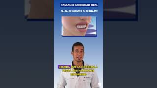 ¿CANDIDIASIS ORAL? Causas de los HONGOS en la BOCA by Dentalk! 667 views 2 months ago 1 minute, 19 seconds