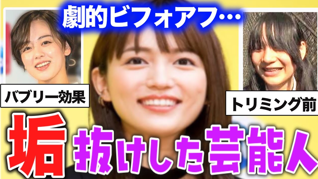 【ガルちゃん芸能】まるで別人⁉ 垢抜けした芸能人の衝撃画像【有益2ch】