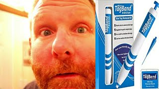 TagBand Skin Tag Removal System |DID IT WORK?????