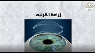 القرنيه المخروطية وصفها وأعراضها وعلاجها / المركز الطبي- الجامعة العربية الأمريكية